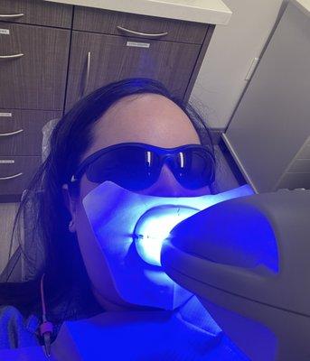 Zoom Whitening! Highly recommend!