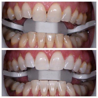 Rebecca Bryan, DDS & John Curtis, DDS - Dental Image Before and After Result