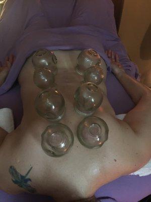 Traditional Chinese Cupping