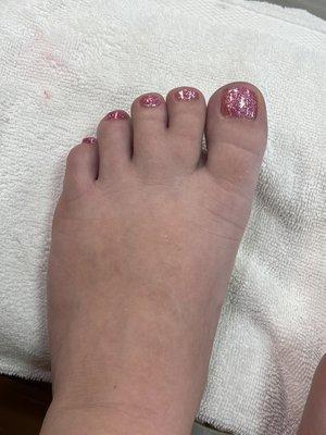 Gel pedicure