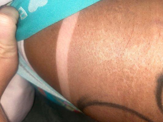 My tan line.