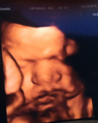 This is an Ultrasound picture of our beautiful son!