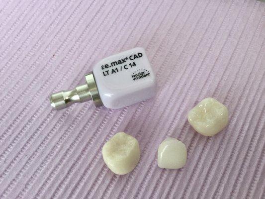 Cerec blocks and crowns.