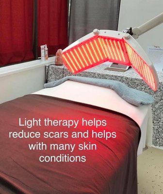 DPL light therapy