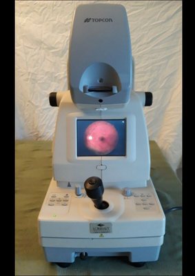 Retinal Camera with an image of my son's retina