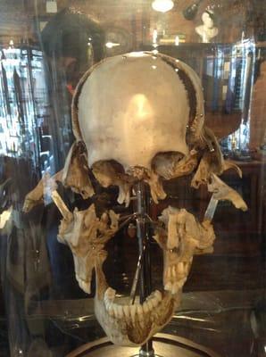 Amazing Victorian anatomical artifacts from the store