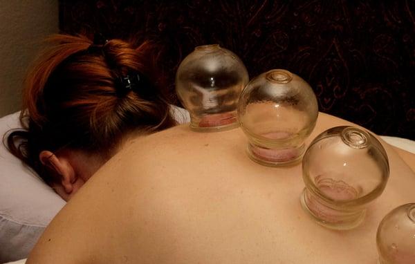 Cupping facilitates blood flow, loosening tight muscles, and relieving pain.