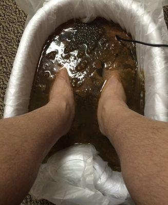 Results of a clients ionic foot detox.