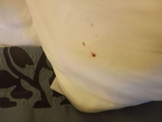 Blood  on pillow