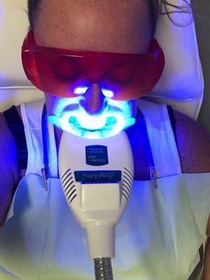 60 minute teeth whitening session