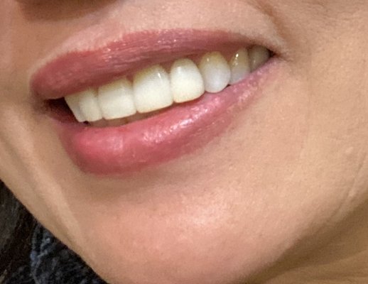 Lan Nguyen DDS