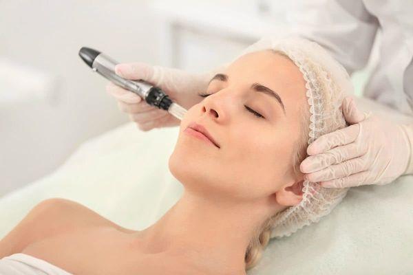 Microneedling service for facial rejuvenation.