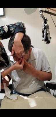 Dr Harthan installing the scleral lens on my eyes.