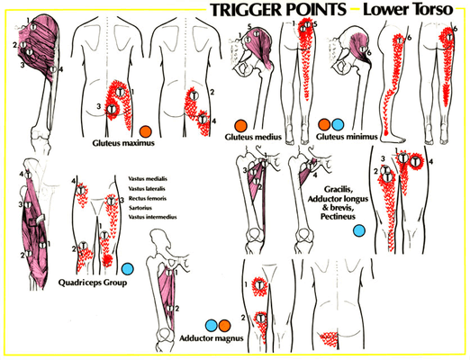 Neuromuscular Trigger apoint