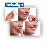 Plattsburgh-NY-Invisalign