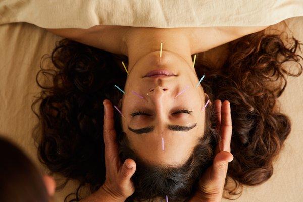 Using acupuncture for beauty can keep the skin elastic and hydrated. Also, it is effective in reducing wrinkles.