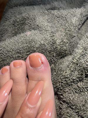 After getting a pedicure