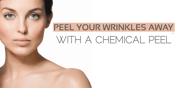 Glycolic Acid , Salicylic Acid, and TCA Peels Offered