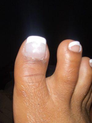 TWO TIPS on ONE toe