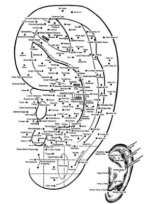 Auricular acupuncture