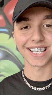 Custom Fit white Gold Grillz