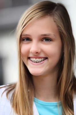 Alexandria dental patient with braces by Dr Joseph M Haack, DDS