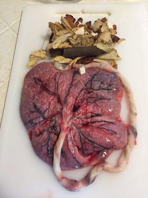 He sent me this beautiful pic! I don't think it's coincidence that a placenta looks like a brain.