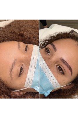 Microblading