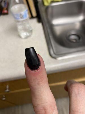 Bad nail experience