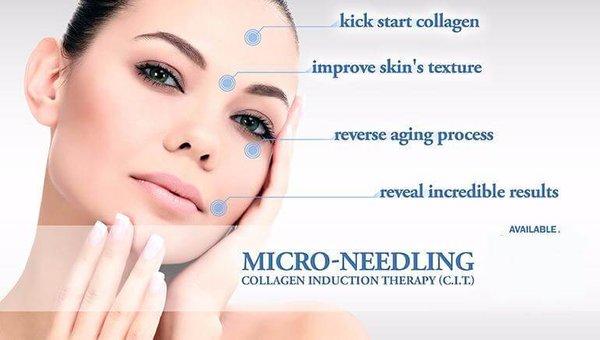 Microneedling Fresno