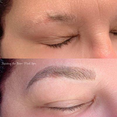 Microblading