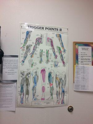 Trigger points