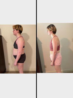 45 lbs lost on Tranquility's Medically Supervised Weight Loss Program