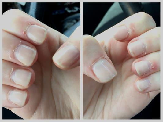 This is what my nails look like after getting an $18 manicure here just 4 DAYS ago. My cuticles are so sore and my left thumb is infected.