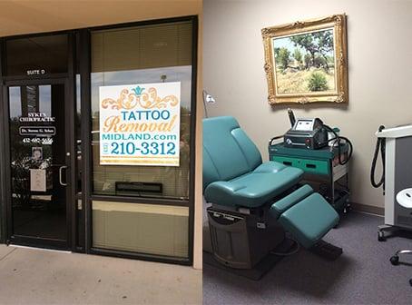 Tattoo Removal Midland