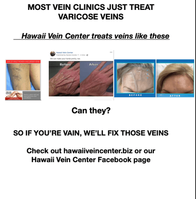 Come for free vein screening.