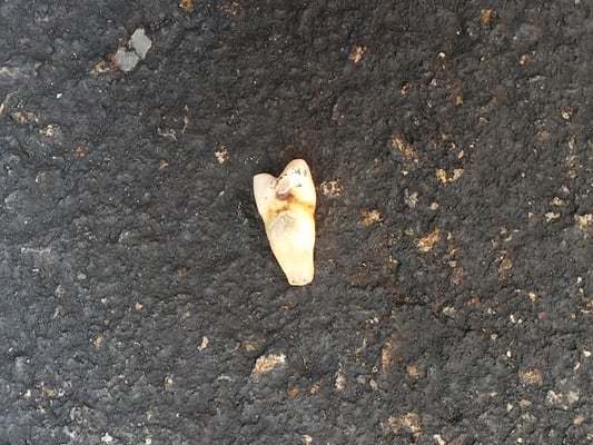 Bloody human tooth found on site.