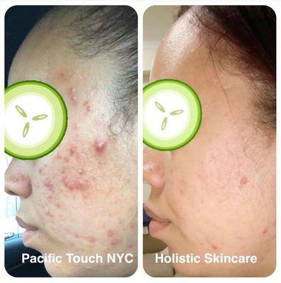 Pacific Touch Skin Transformation