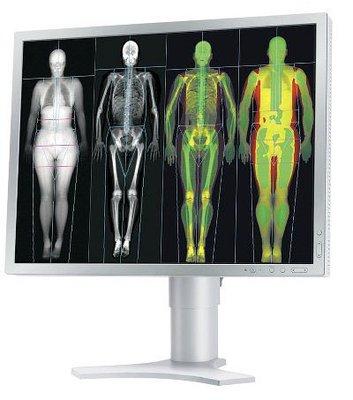 Accurate data of your complete body composition using DXA technology.