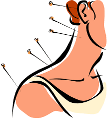 The acupuncture doctors are highly skilled and get great results. Go here for Dry Needling