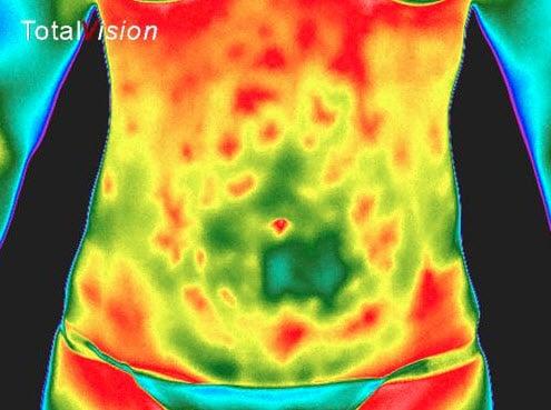 Thermographic scan showing food allergies