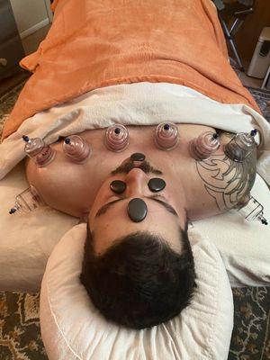 Hot Stone + Ancient Cupping Therapeutic Massage