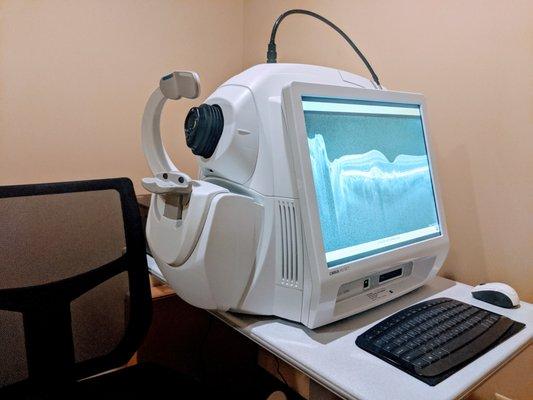 OCT technology to manage many eye diseases