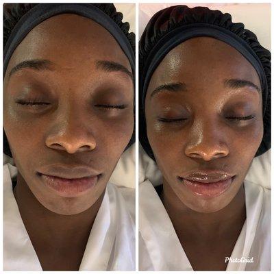 Bridal glam facial treatment