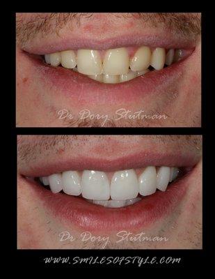 Dr Dory Stutman, South Shore Dental care, porcelain veneers, implants, crowns, dentist, cosmetic dentistry. bleaching,whitening, invisalign