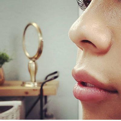 Lip Injections 1 of our Top Service