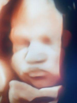 Sneak A Peek 4D Ultrasounds