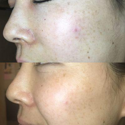 Custom Rejuvenating Facial