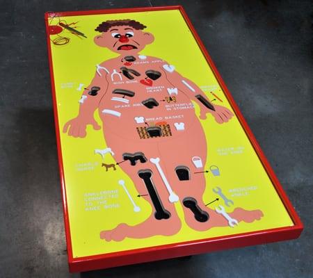 Giant Operation, at 6' Long. Players use giant tongs to carefully try to take specified body parts out of the patient board.