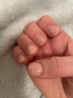 Two nails fell off after 1.5 weeks (dip manicure)